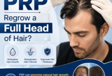 Can PRP regrow a full head of hair?